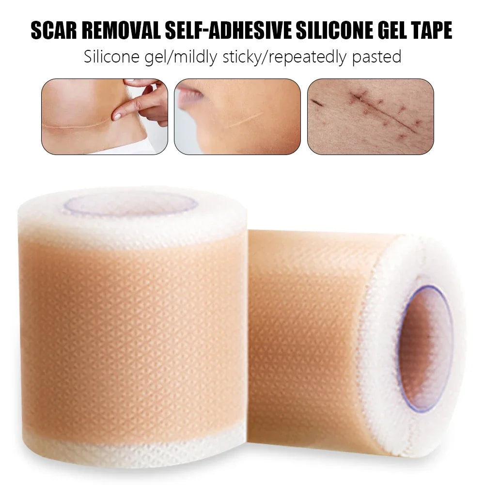 50-150cm Efficient Surgery Scar Removal Silicone Gel Tape Self Adhesive Therapy Patch for Acne Trauma Burn Scar Skin Repair